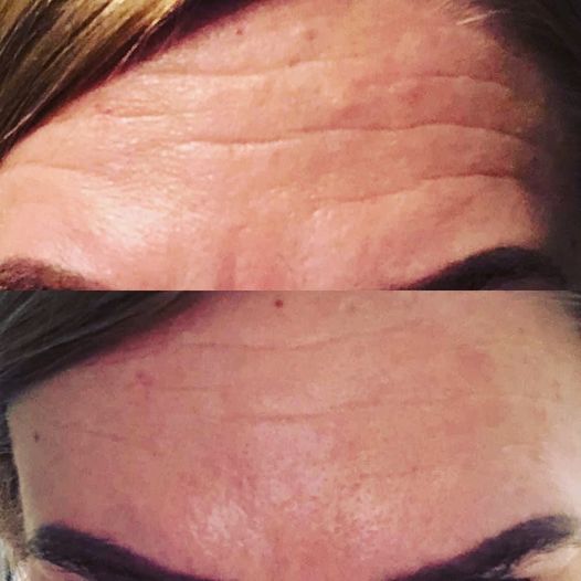 
                  
                    Load image into Gallery viewer, NEW Herbalife Collagen Skin Booster
                  
                