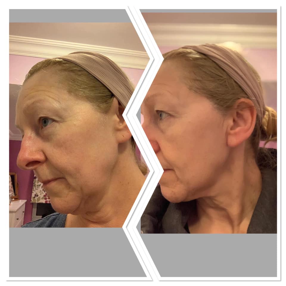 
                  
                    Load image into Gallery viewer, NEW Herbalife Collagen Skin Booster
                  
                