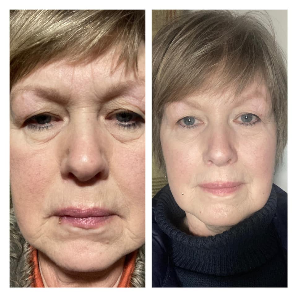 
                  
                    Load image into Gallery viewer, NEW Herbalife Collagen Skin Booster
                  
                
