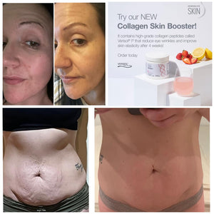
                  
                    Load image into Gallery viewer, NEW Herbalife Collagen Skin Booster
                  
                