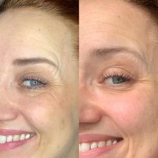 
                  
                    Load image into Gallery viewer, NEW Herbalife Collagen Skin Booster
                  
                