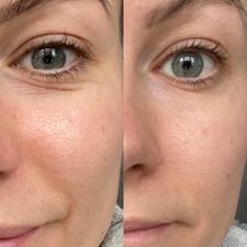 
                  
                    Load image into Gallery viewer, NEW Herbalife Collagen Skin Booster
                  
                