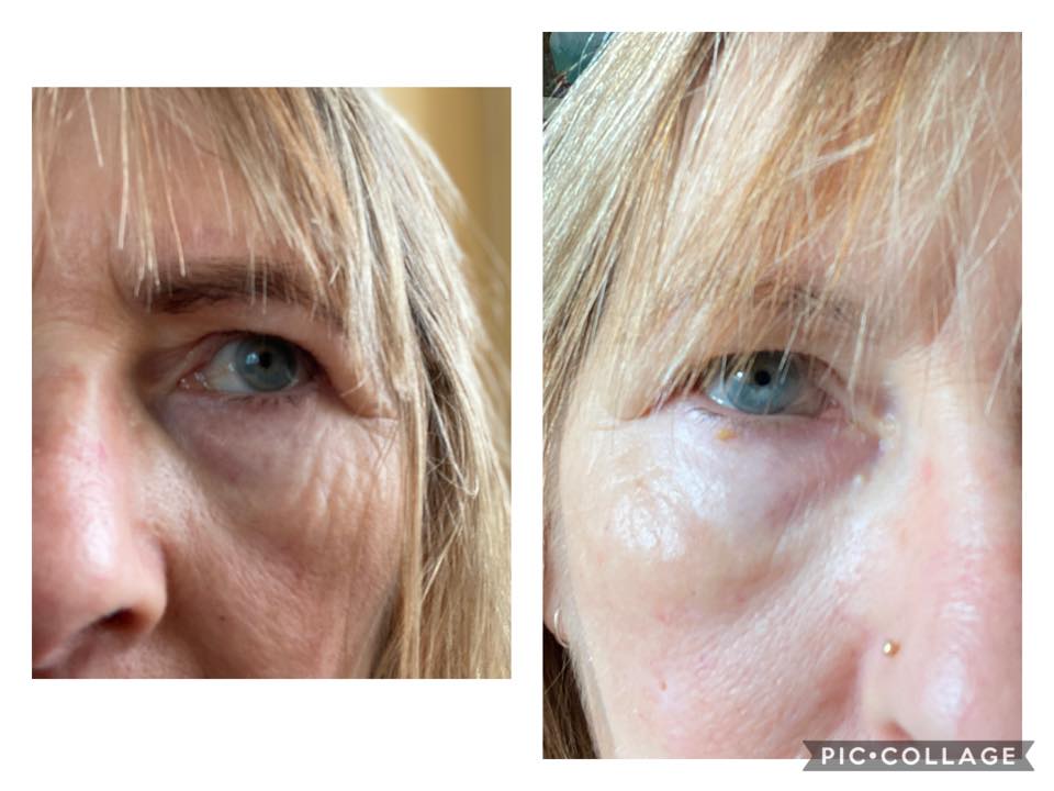 
                  
                    Load image into Gallery viewer, NEW Herbalife Collagen Skin Booster
                  
                